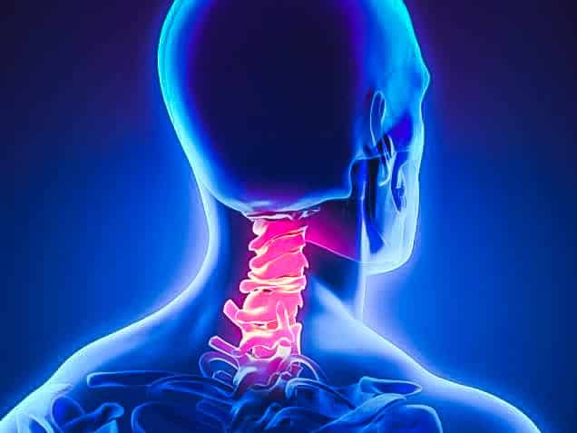 Fitness Center Manager Suffers Cervical Strain Injury [2016]