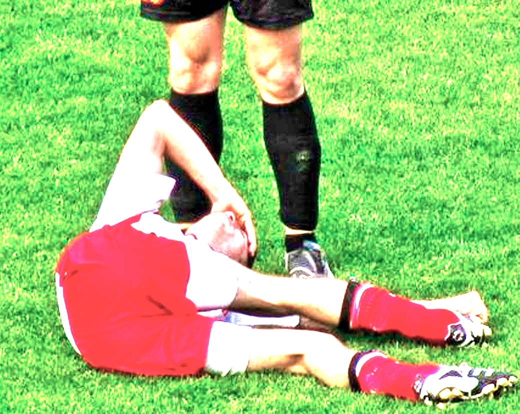 What is a Concussion