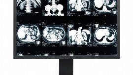 Most Malpractice Claims Caused by Missed Diagnoses and Medication Errors