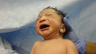 Role of Chronic Conditions in Pediatric Medical Malpractice