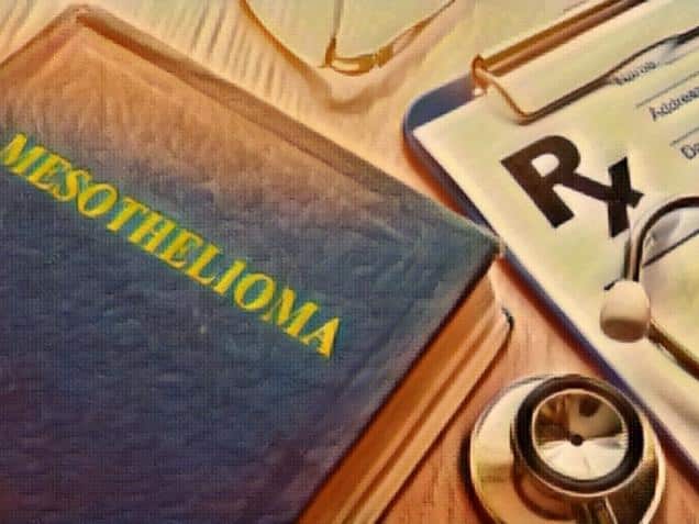 book about Mesothelioma and stethoscope on a table