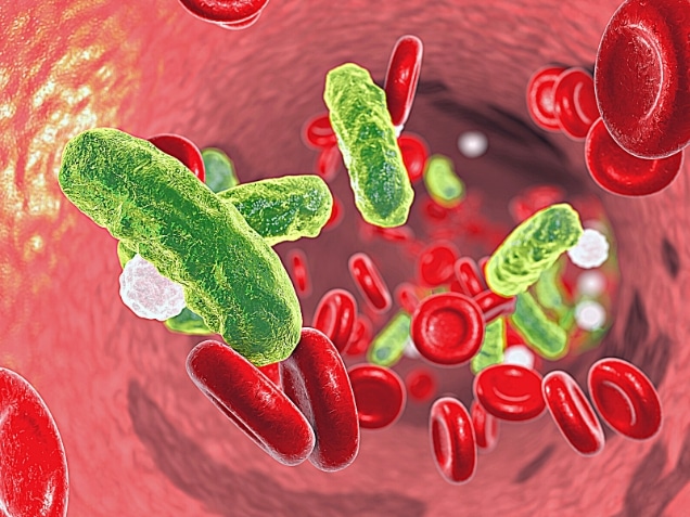 bacteria in blood. concept of stages of sepsis