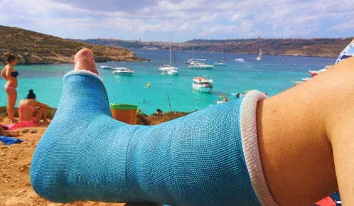 Man's foot on cast sitting by the beach. Tourist Injuries in Chicago